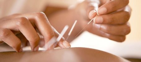 Toyahari acupuncture Brisbane